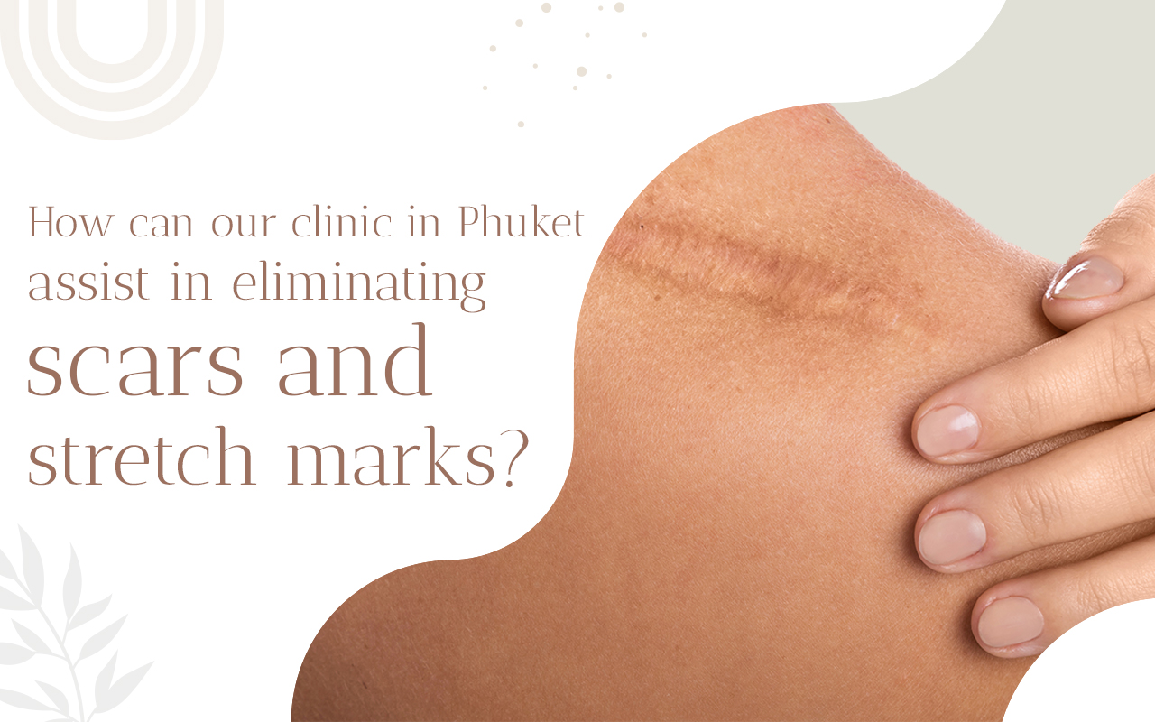 scar removal in phuket